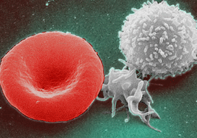 Infección urinaria y Hematuria