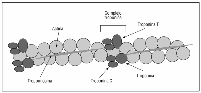 troponinas